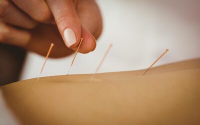 La pratica dell’agopuntura