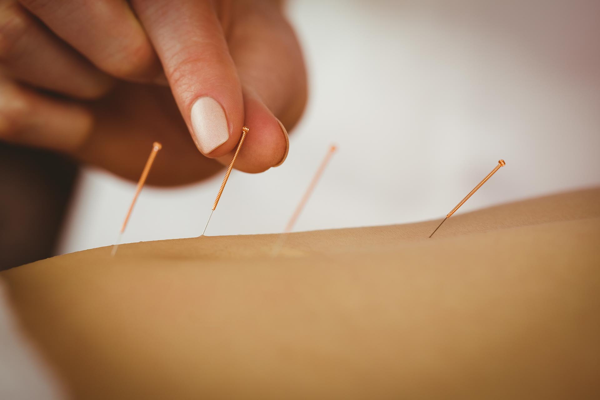 L'agopuntura viene utilizzato per trattare il dolore cronico alla testa, alle articolazioni, alla schiena.