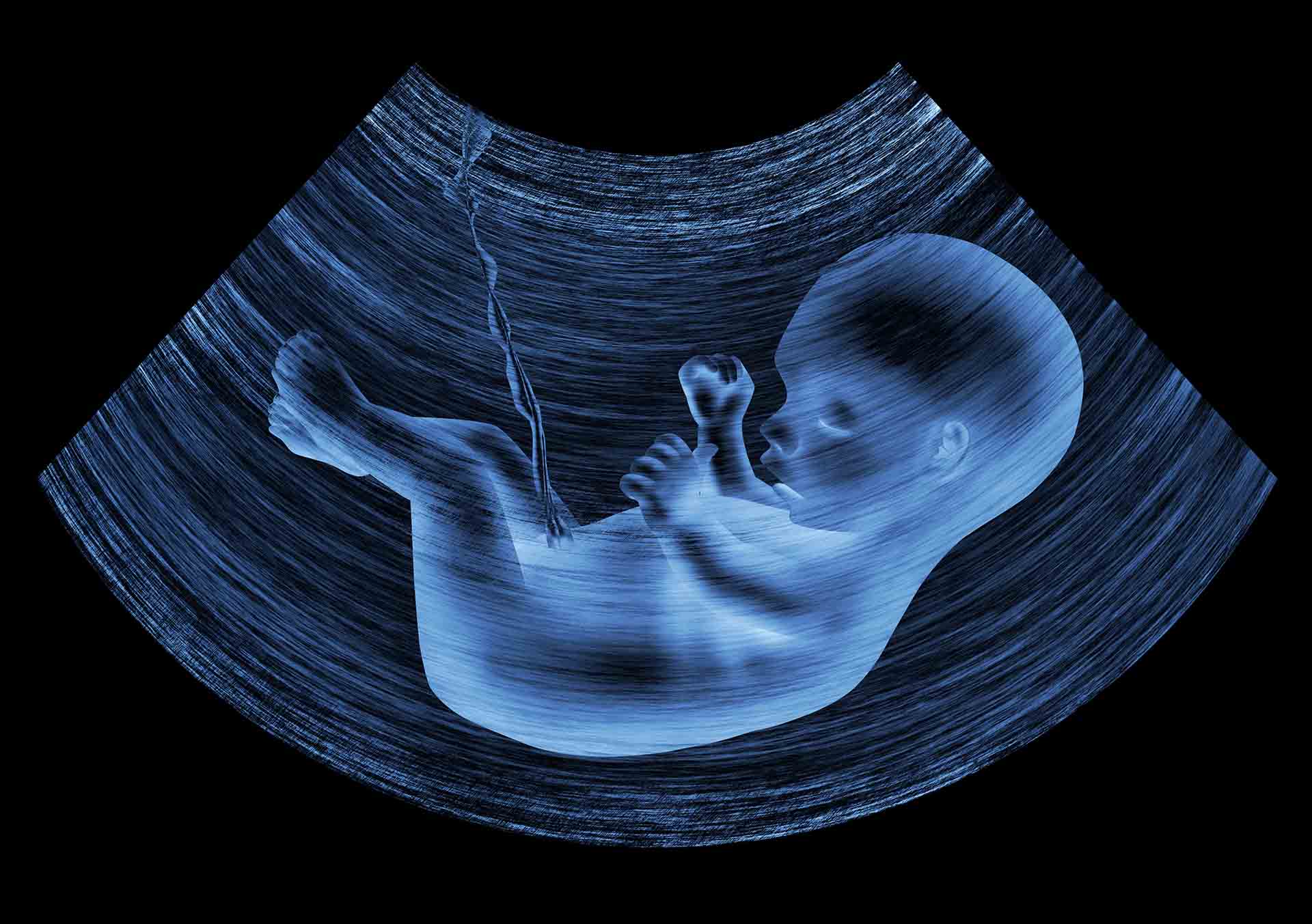 ecografia morfologica 3D permette di visualizzare in modo molto dettagliato il feto durante l'arco della gravidanza.